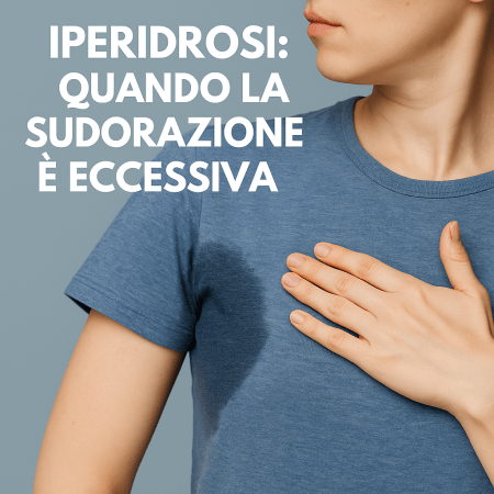 Persona con iperidrosi ascellare e macchia di sudore evidente sulla maglietta, immagine per articolo sui trattamenti della sudorazione eccessiva.