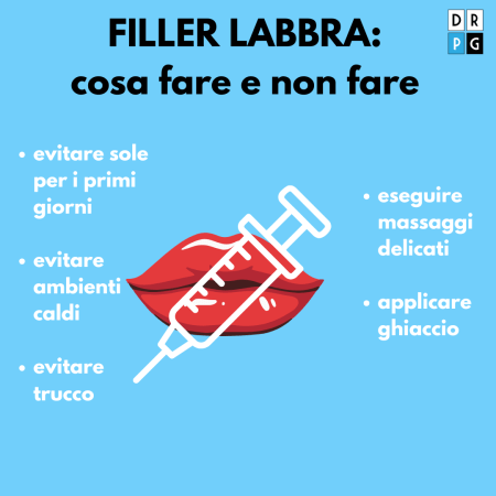 cosa evitare prima e dopo un filler labbra