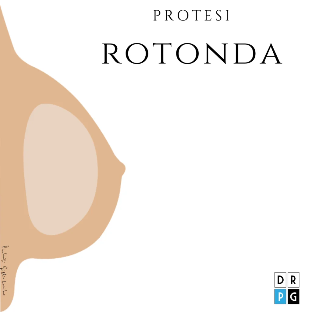 protesi mammaria rotonda &ndash; forma regolare