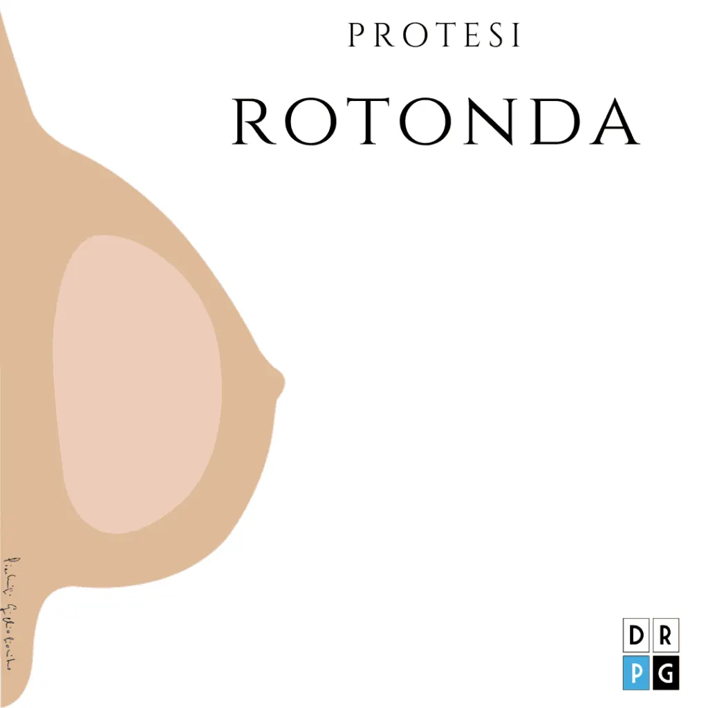 protesi mammaria rotonda – forma regolare