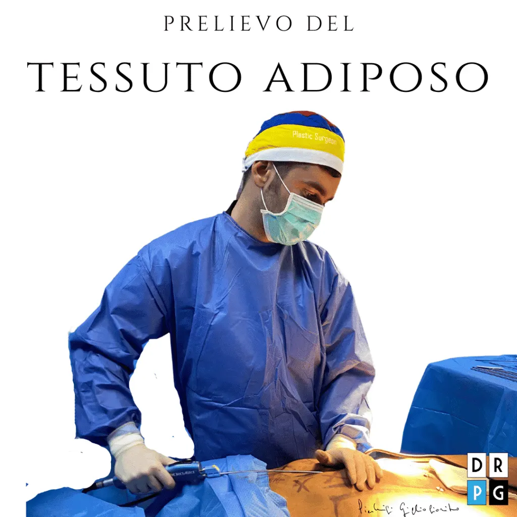 prelievo grasso per mastoplastica ibrida