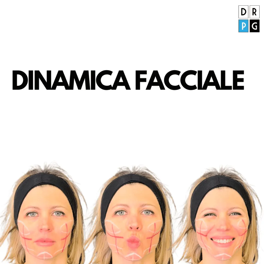 pianificazione del filler dinamico in base alla mimica facciale in movimento