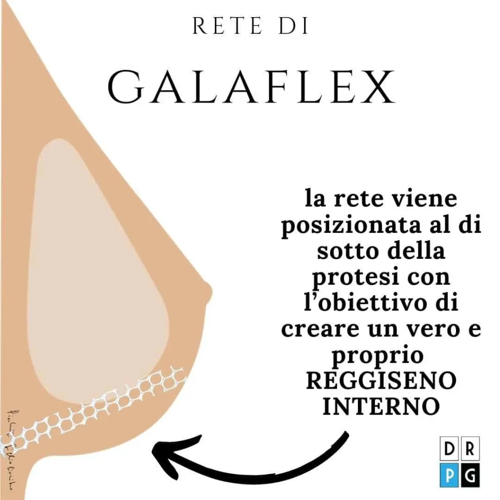 schema reggiseno interno con Galaflex seno