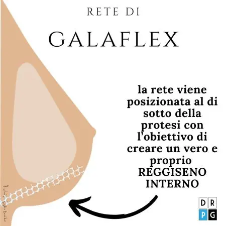 galaflex