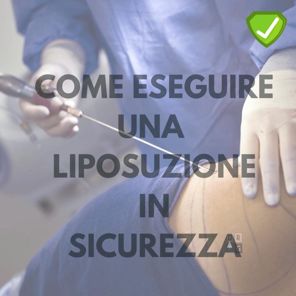 Tecnica di liposuzione eseguita in sicurezza dal chirurgo – Dr. Pierluigi Gigliofiorito