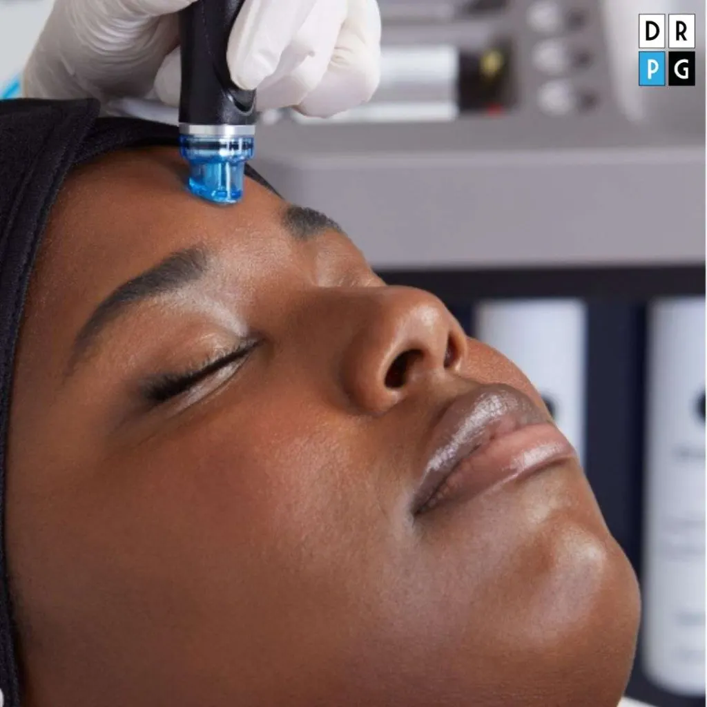 Pulizia profonda viso con tecnologia a vortice Hydrafacial a Milano