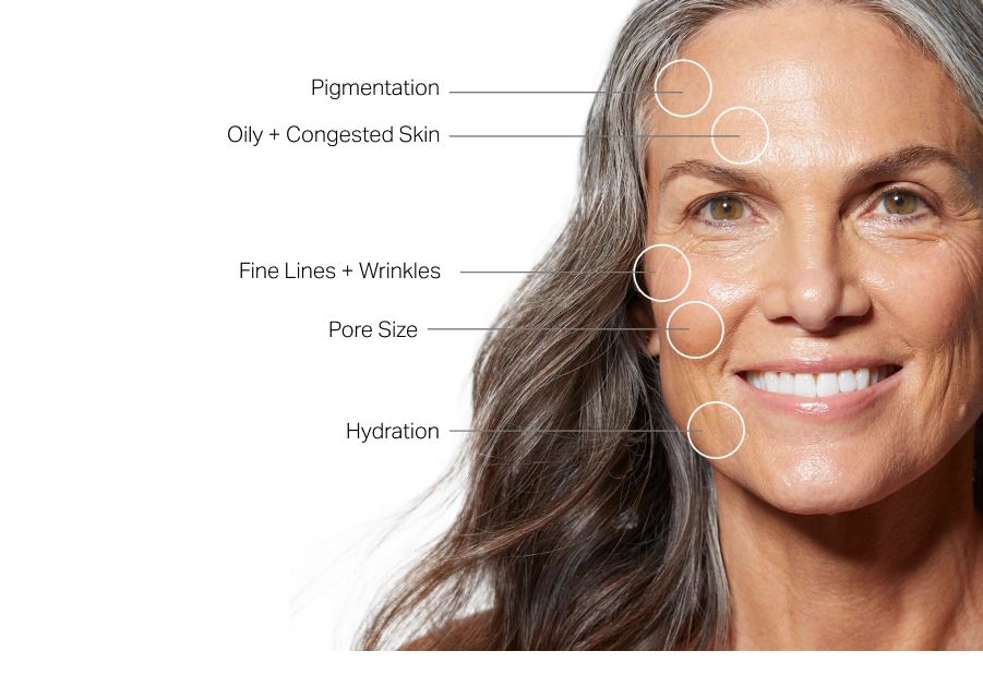 indicazioni all'hydrafacial a milano