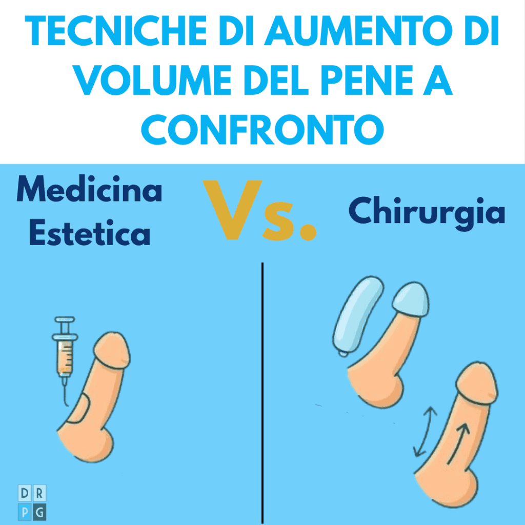 tecniche di aumento del pene a confronto e differenza tra filler e protesi e allungamento