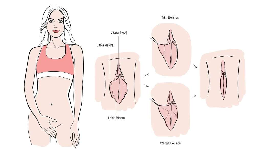 Consulto preoperatorio di chirurgia intima con il Dr Gigliofiorito