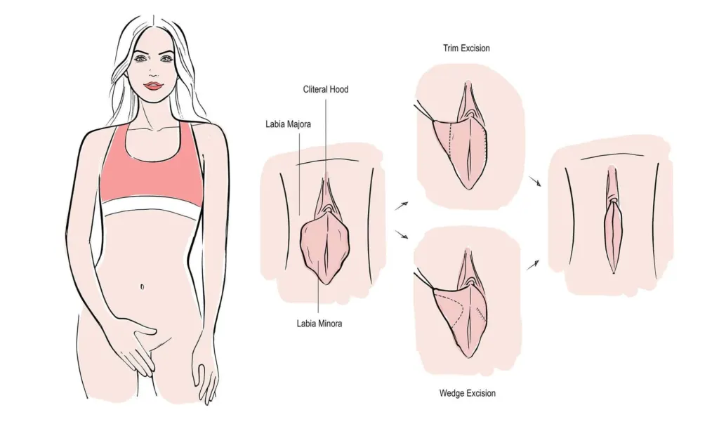 Consulto preoperatorio di chirurgia intima con il Dr Gigliofiorito