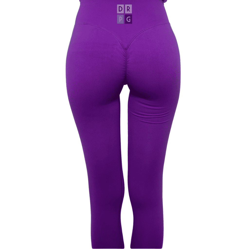 filler glutei Napoli risultato naturale G-Fill