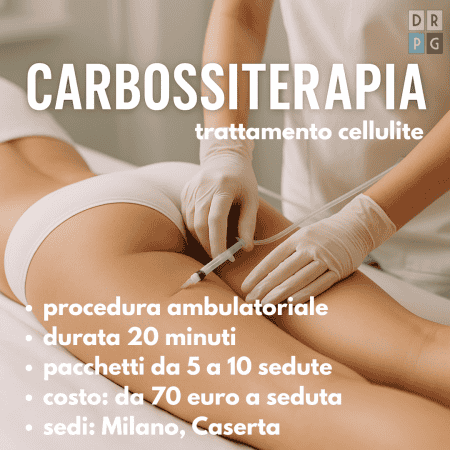 carbossiterapia milano dr pierluigi gigliofiorito trattamento medico per cellulite e ritenzione
