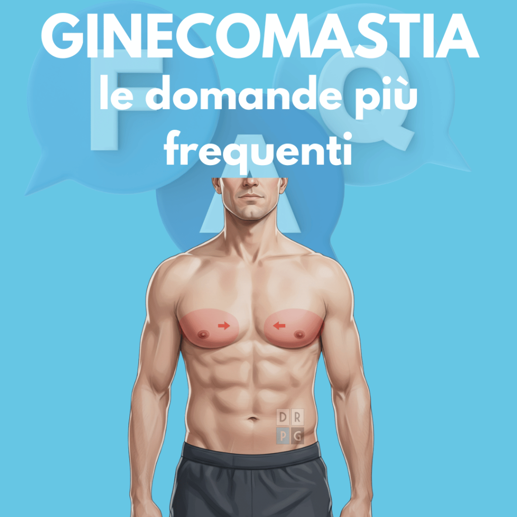 Domande frequenti sulla ginecomastia spiegate dal Dr. Gigliofiorito, chirurgo plastico a Milano e Caserta.