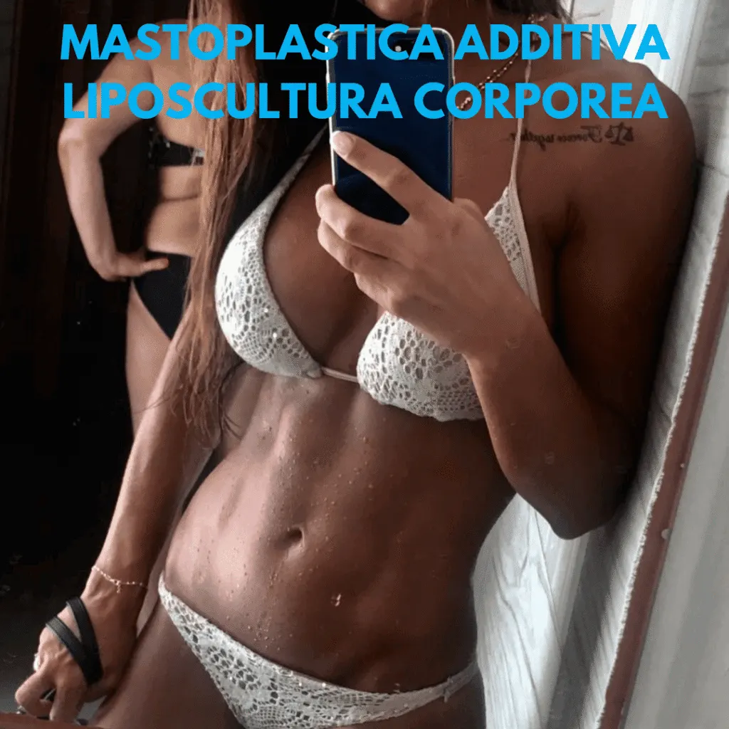 mastoplastica additiva e liposuzione a napoli eseguita dal dr. Pierluigi Gigliofiorito