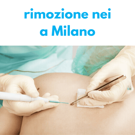 rimozione nei milano dr pierluigi gigliofiorito chirurgia dermatologica estetica