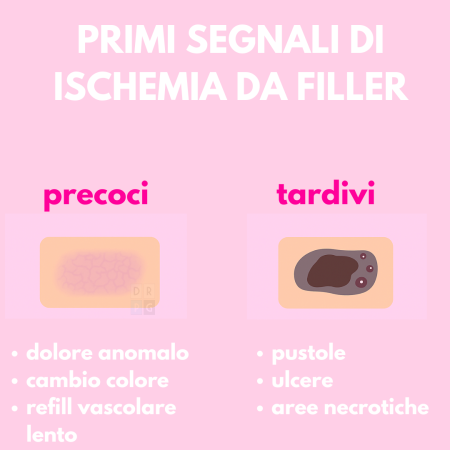 Primi segnali di ischemia da filler – Dr. Gigliofiorito