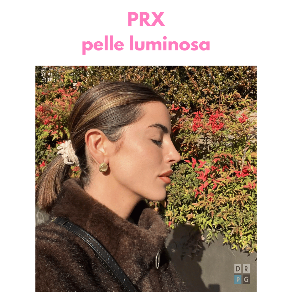 risultato PRX a Milano con pelle più luminosa e uniforme dopo trattamento biostimolante