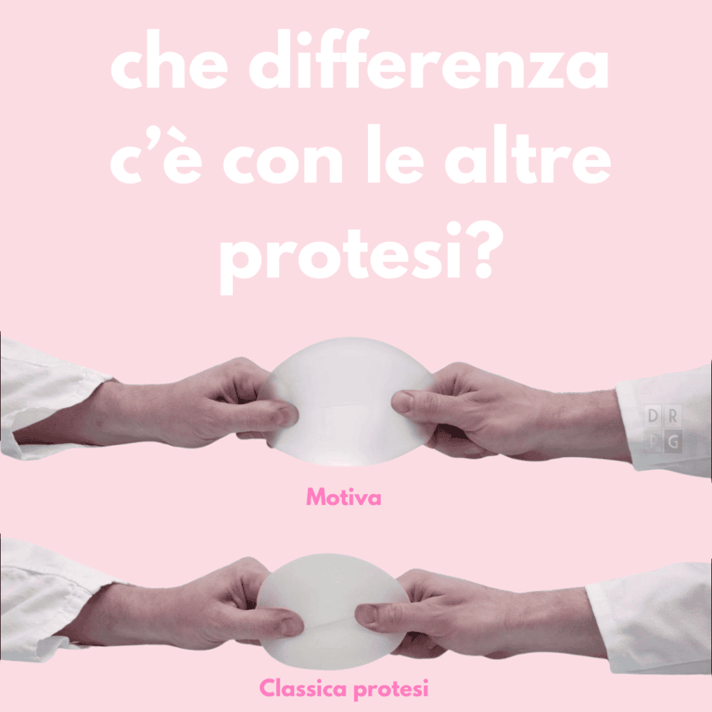 Confronto tra protesi Motiva ergonomica e protesi mammaria tradizionale
