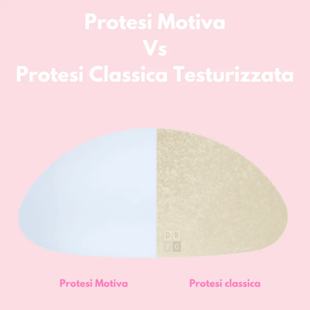 Confronto tra protesi Motiva ergonomiche e protesi mammarie classiche testurizzate