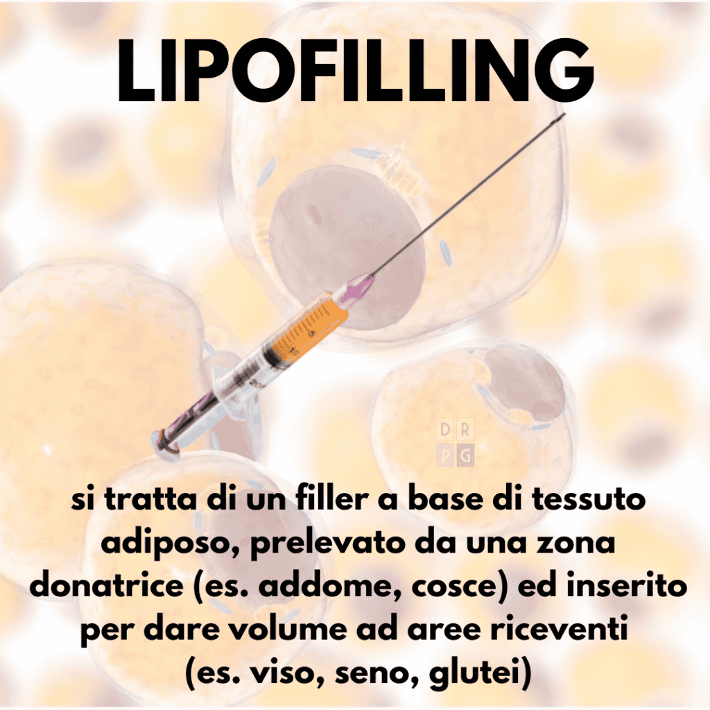 Cellule adipose utilizzate nel lipofilling per il rimodellamento corporeo tramite iniezione di grasso