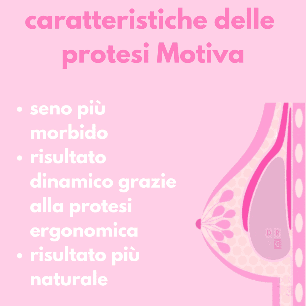 Schema delle protesi Motiva ergonomiche e loro comportamento dinamico nel seno