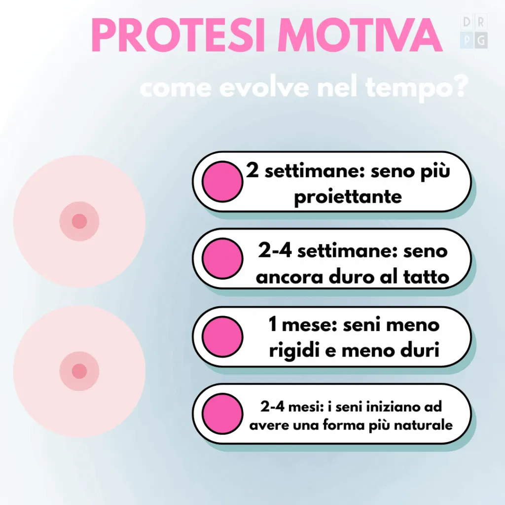 Evoluzione nel tempo delle protesi Motiva dopo mastoplastica additiva: proiezione e naturalezza
