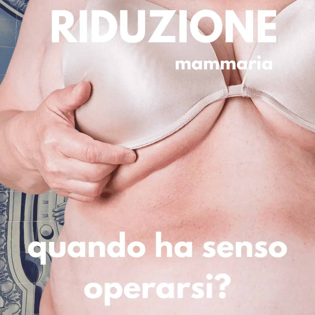 riduzione mammaria quando ha senso operarsi

