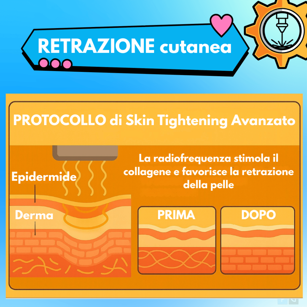 radiofrequenza per stimolare il collagene e migliorare la retrazione della pelle
