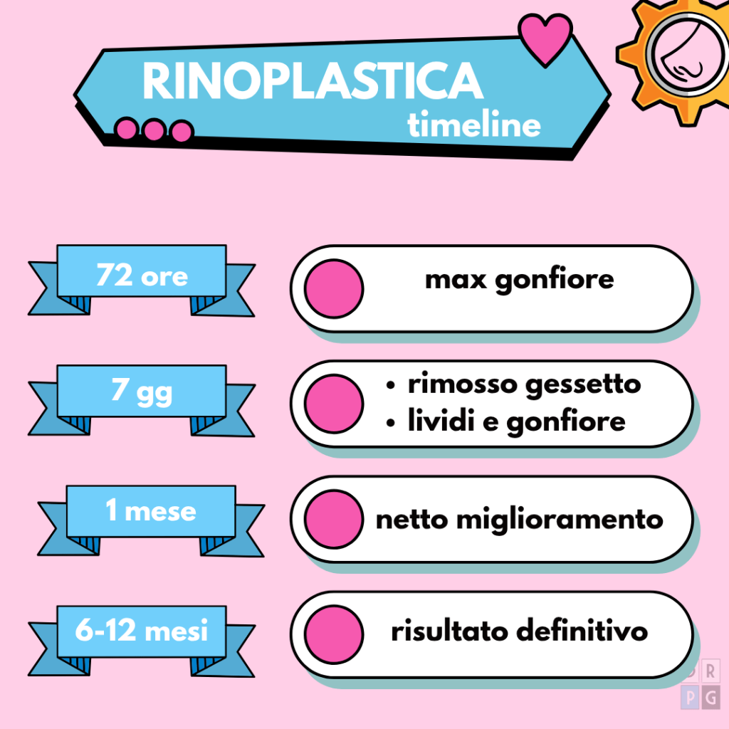timeline rinoplastica recupero 72 ore 7 giorni 1 mese risultato definitivo